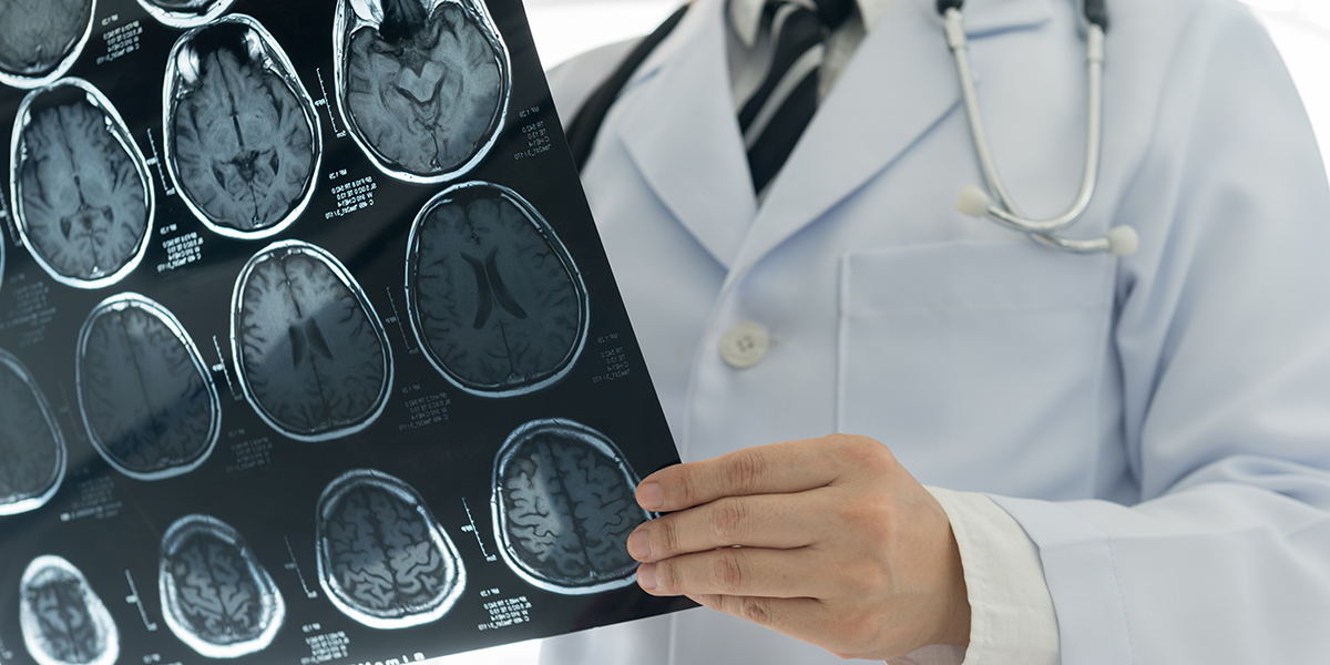 What Can A Ct Scan Detect In The Head