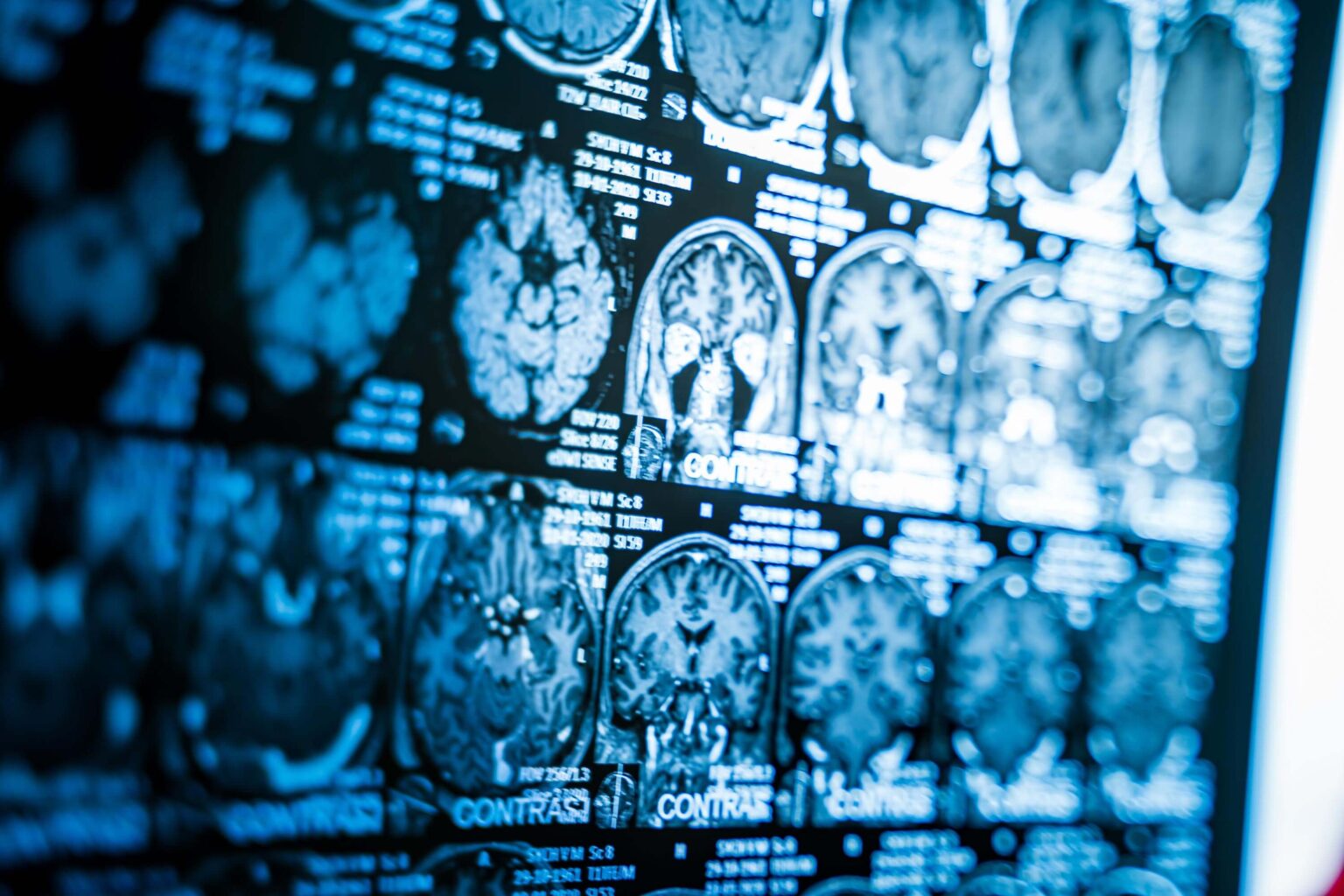 How a Brain Scan Can Help Diagnose Mental Illness