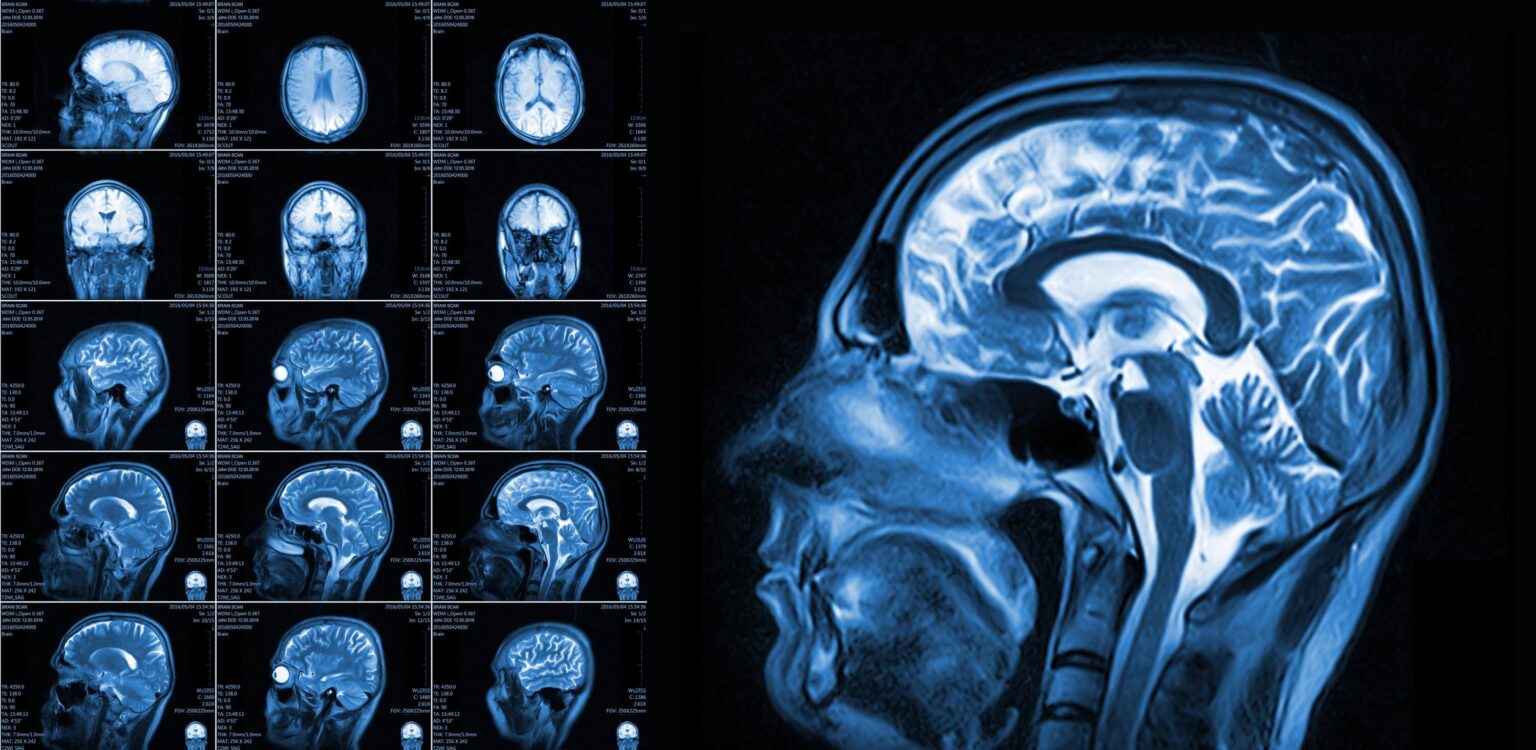 How is an MRI used to detect brain tumors? • American Health Imaging