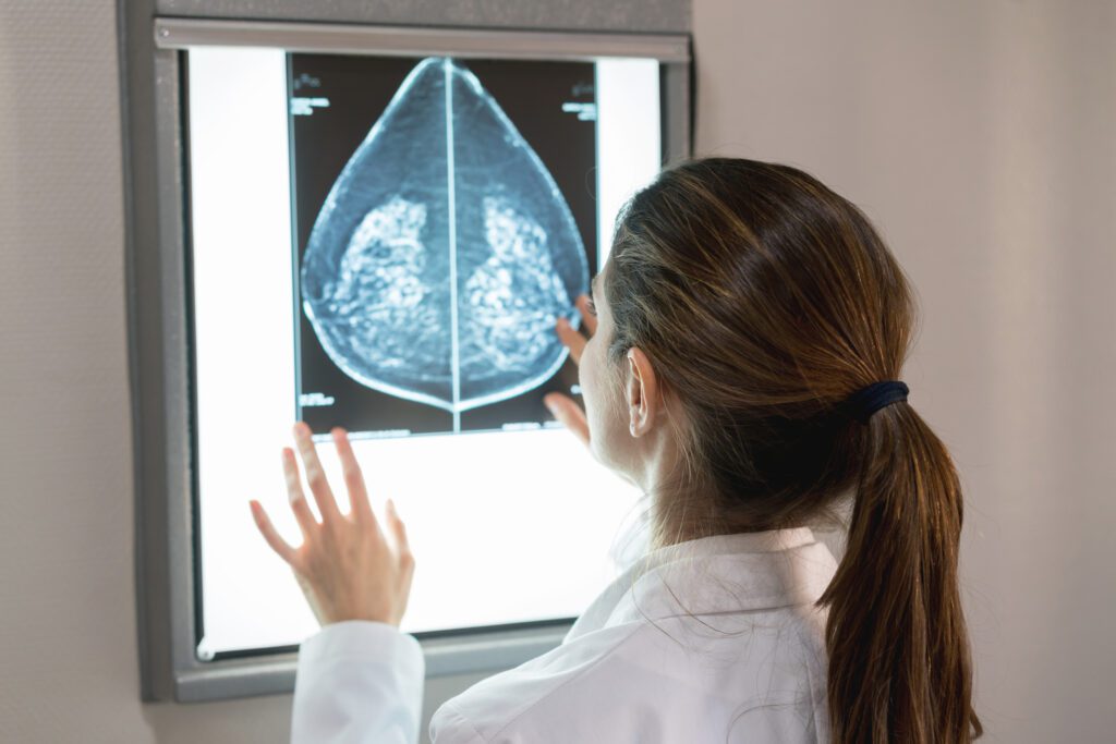 It's important women with dense breast tissue receive a mammogram and AB MRI screening.