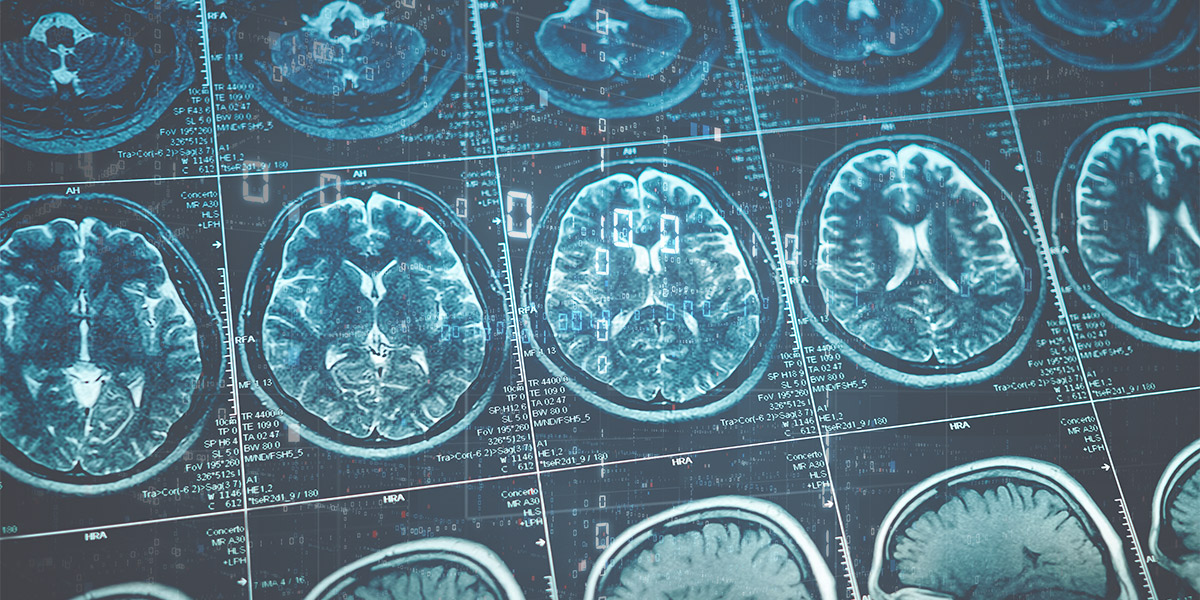 Brain - American Health Imaging