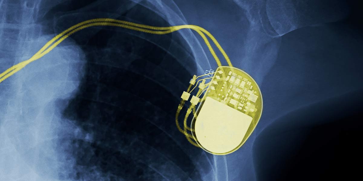 MRI With Pacemaker: Is It Safe? • American Health Imaging