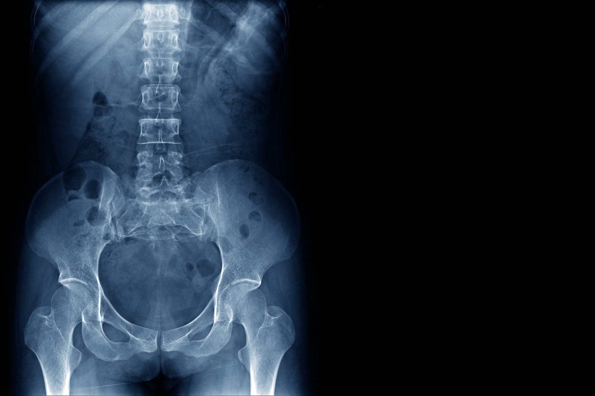 Bone Density Scan (DEXA) • American Health Imaging