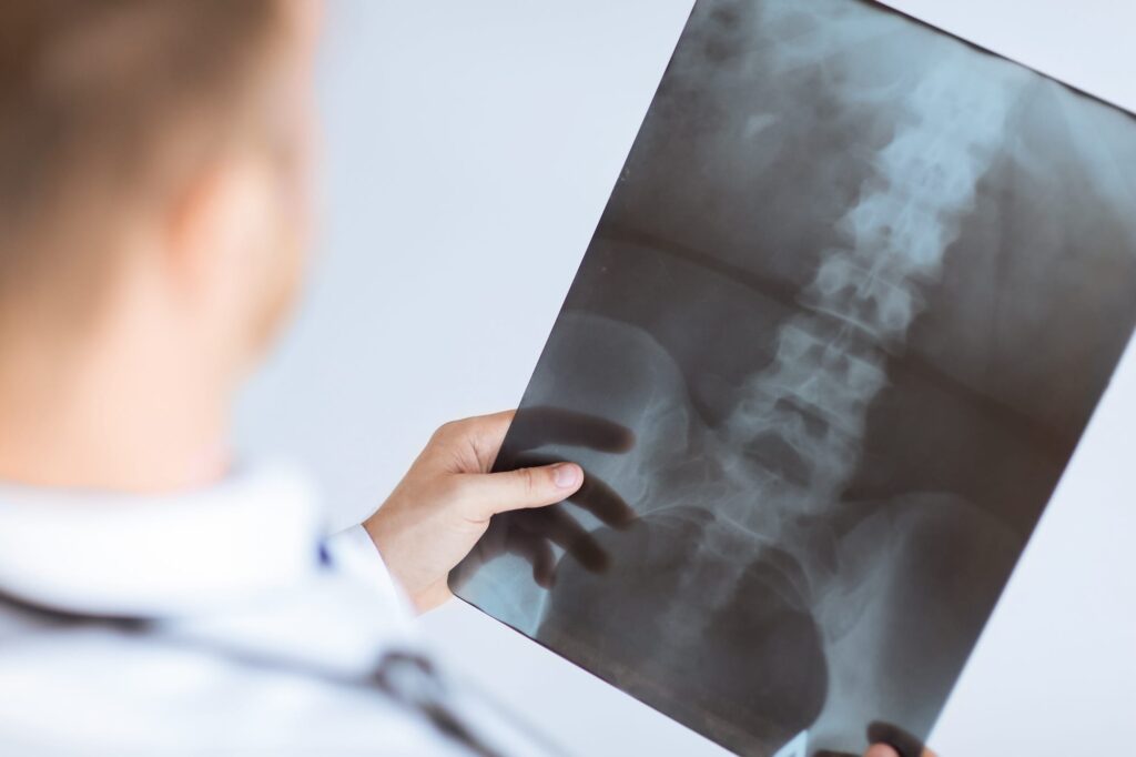Myelogram Spinal Imaging • American Health Imaging • X-Ray