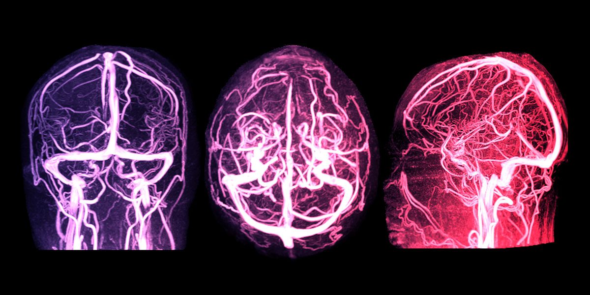 What You Need To Know About MRI With Contrast American Health Imaging
