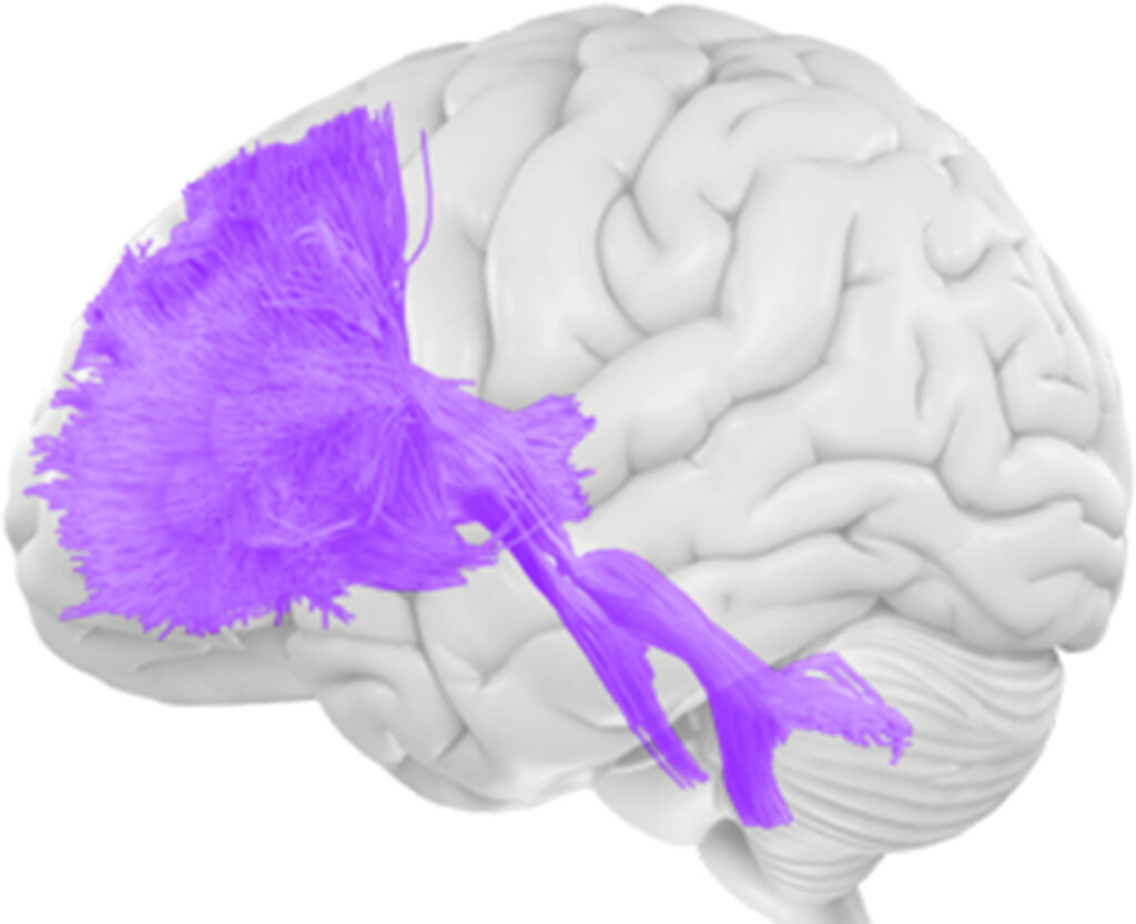 Diffusion Tensor Imaging • American Health Imaging